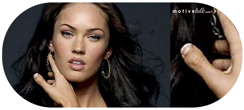 Celebrities with Deformities